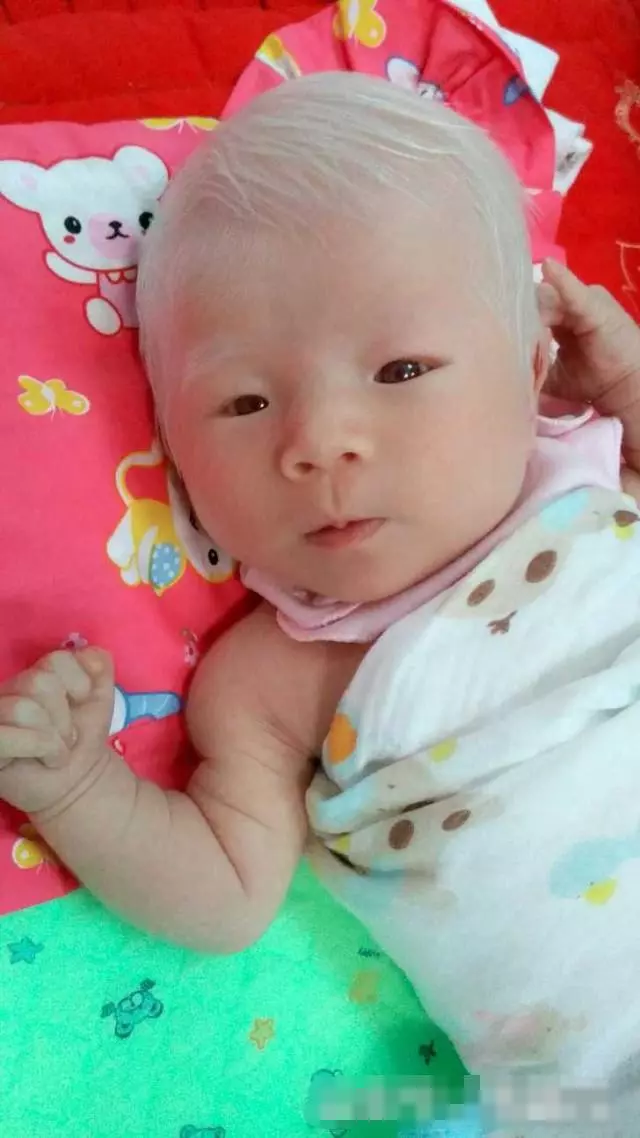 剛出生的女兒「一頭白髮」,漂亮至極!但醫生的「一番話」卻讓媽媽陷入了深深地痛苦之中!!