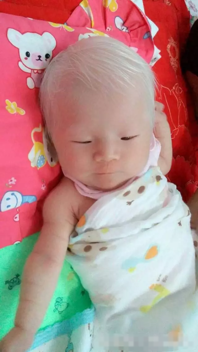 剛出生的女兒「一頭白髮」,漂亮至極!但醫生的「一番話」卻讓媽媽陷入了深深地痛苦之中!!