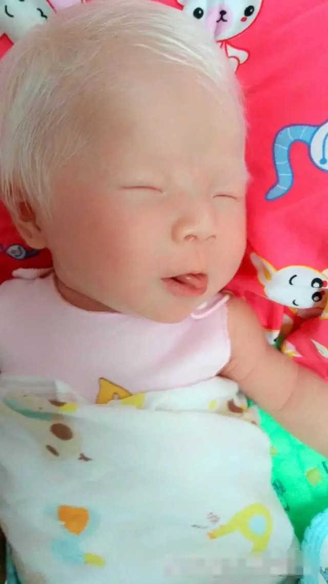 剛出生的女兒「一頭白髮」,漂亮至極!但醫生的「一番話」卻讓媽媽陷入了深深地痛苦之中!!