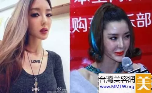 46歲鍾麗緹遭偷拍「臉上滿滿針孔」!女星為了不老「亂打針的下場」竟是....嚇到腿軟!