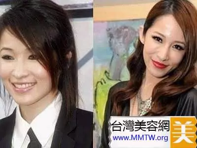 46歲鍾麗緹遭偷拍「臉上滿滿針孔」!女星為了不老「亂打針的下場」竟是....嚇到腿軟!