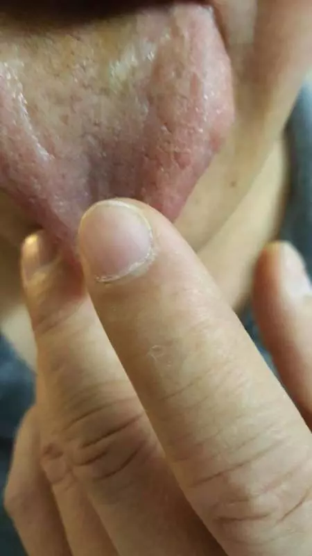 舌尖上的驚魂 喝咖啡喝到滿口血