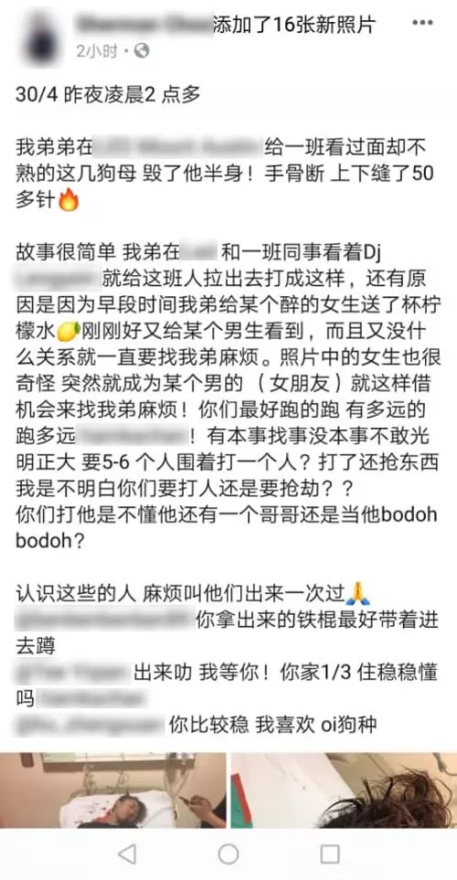 只是點了一杯檸檬水給醉酒女, 男子被00後鐵棍破頭縫50多針‼ 哥哥網上肉搜加害者~