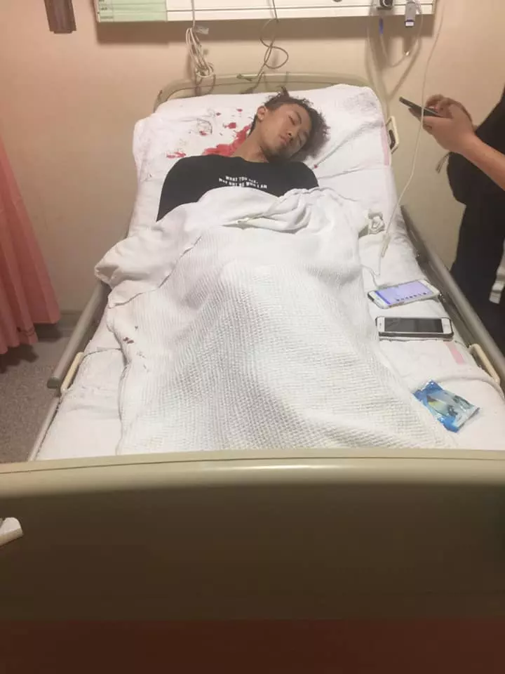 只是點了一杯檸檬水給醉酒女, 男子被00後鐵棍破頭縫50多針‼ 哥哥網上肉搜加害者~