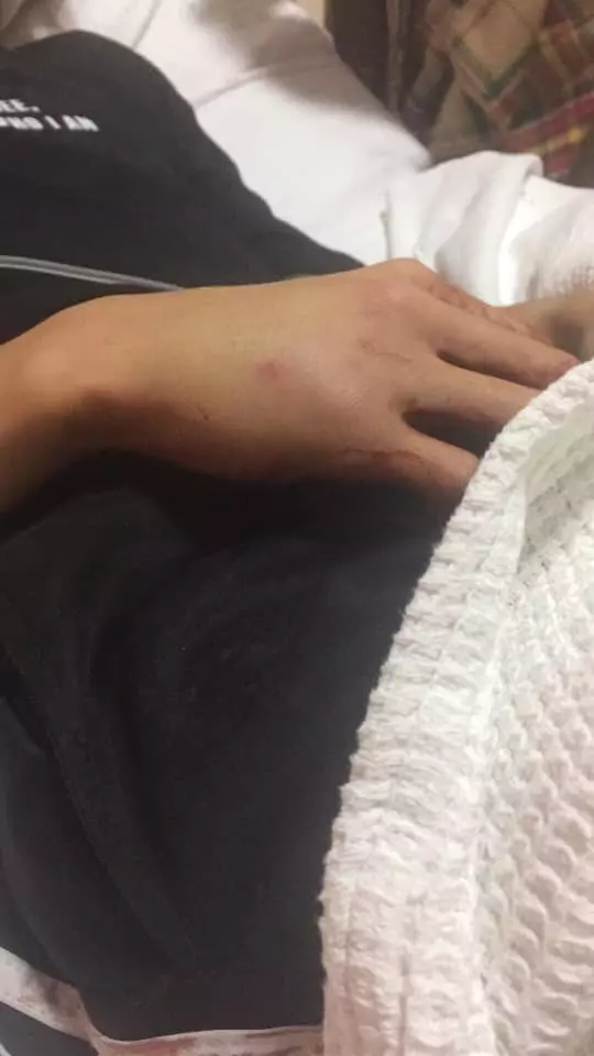 只是點了一杯檸檬水給醉酒女, 男子被00後鐵棍破頭縫50多針‼ 哥哥網上肉搜加害者~