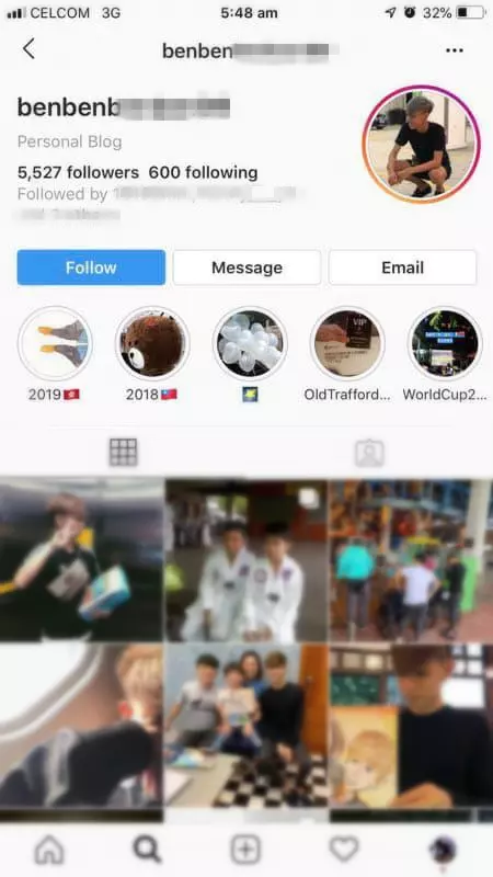 只是點了一杯檸檬水給醉酒女, 男子被00後鐵棍破頭縫50多針‼ 哥哥網上肉搜加害者~