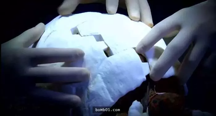 龜殼整個被燒毀的烏龜原以為必死無疑時,一群腦洞大開的醫生竟為牠打造出「帥斃的龜殼」!