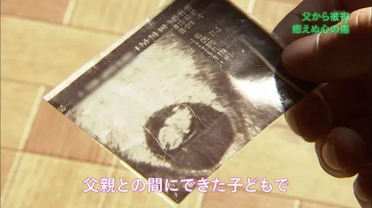 爸爸姓「醜」 阿嬤給「龍鳳胎」取名 醫生護士「拍手叫好」 太有才了!