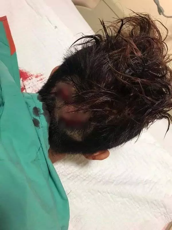 哥哥在網上大踢爆!傷人者身份曝光!包括這名「綠茶婊子」!