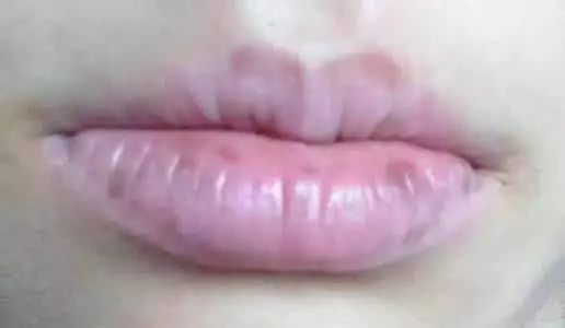 心臟不好的人,臉上會有4種表現,若都沒有,恭喜,你心臟還不錯