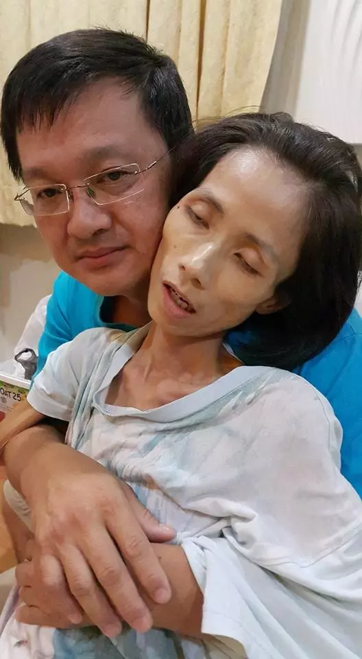 只因長期吃「這種東西」導致胃癌,一年間體重驟降30kg後病逝,為了健康,請不要再吃這個了!