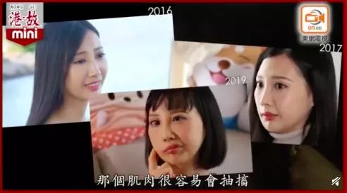 29歲歌手李明蔚抗癌失敗,毀容又失聲,坦言只希望自己能活到7月 !