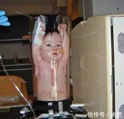 嬰兒被強行塞進「玻璃瓶」引網友唾罵,背後的原因卻令人感動!