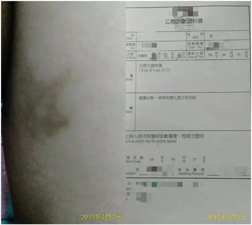 現在的社會為什麼會這樣 小6生慘遭同學霸凌2年!母淚訴:要受多少污辱才能畢業?