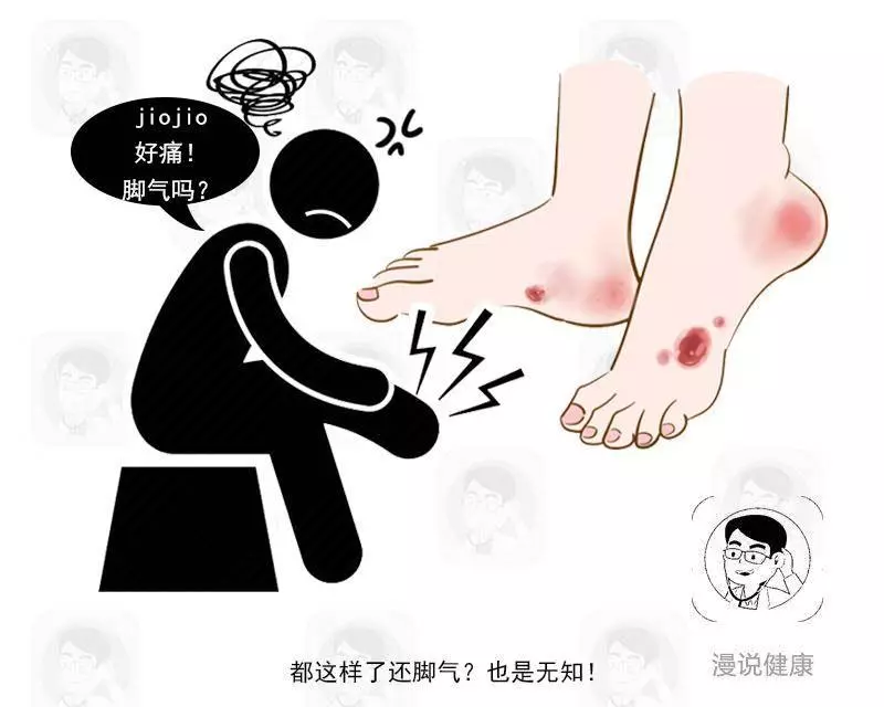 有沒有糖尿病,通過皮膚3個細節就能確認?醫生揭曉答案