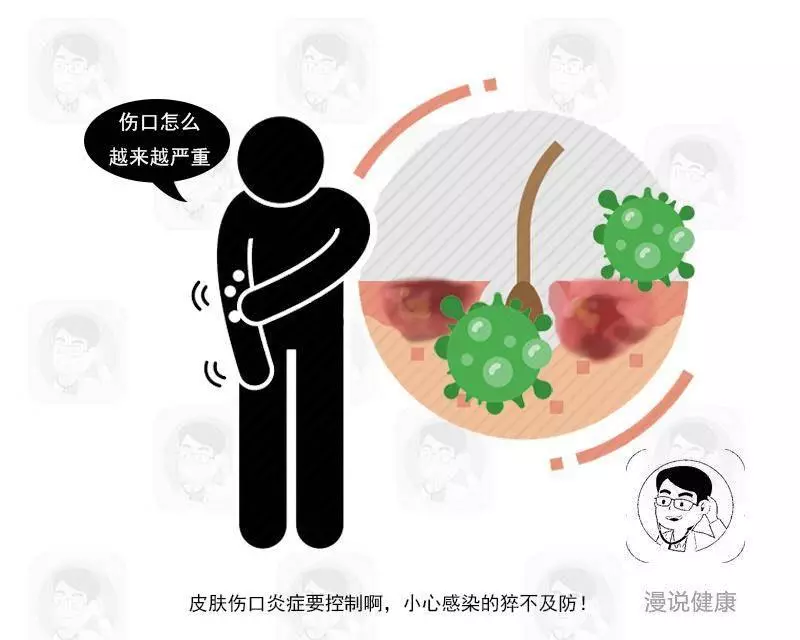 有沒有糖尿病,通過皮膚3個細節就能確認?醫生揭曉答案