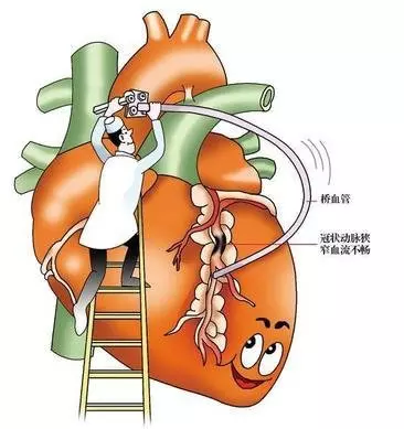 心臟衰竭沒救了,只能等死?保養心臟,請你這樣做!