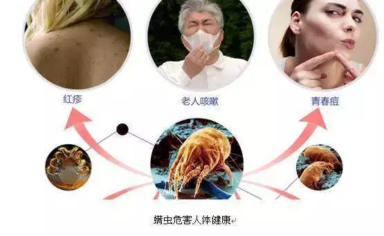 皮膚上出現3種症狀,你家蟎蟲已經「做窩」了,教你4個土辦法,蟎蟲消滅乾淨