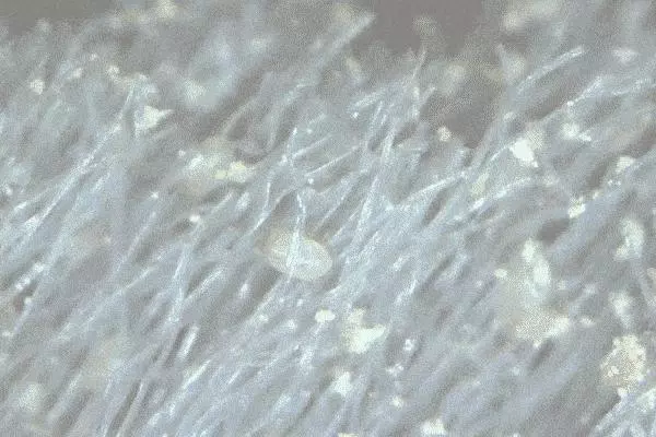 皮膚上出現3種症狀,你家蟎蟲已經「做窩」了,教你4個土辦法,蟎蟲消滅乾淨