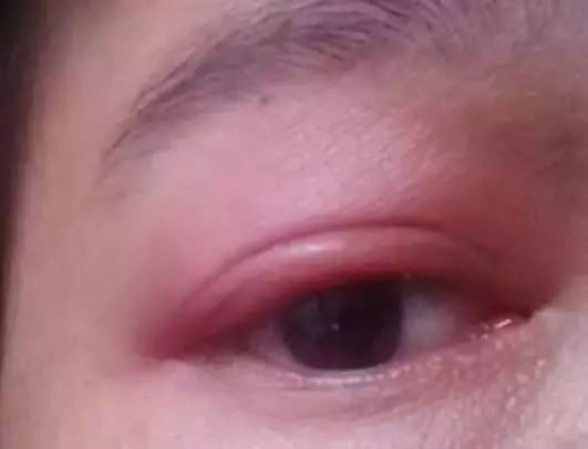 皮膚上出現3種症狀,你家蟎蟲已經「做窩」了,教你4個土辦法,蟎蟲消滅乾淨