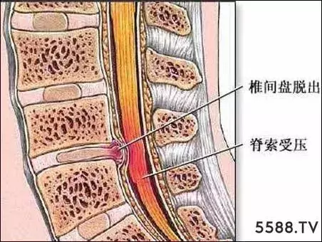 為什麼脖子一轉就咔咔響 ?