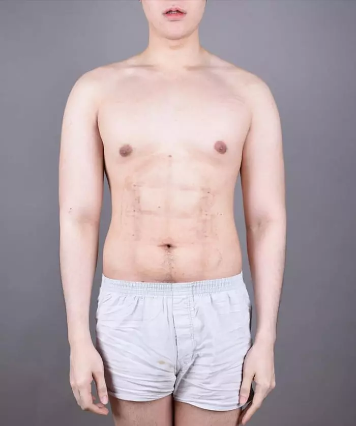 肚肚肥肉抽脂秒變「8塊腹肌」 新整形成果網驚:看不出來!