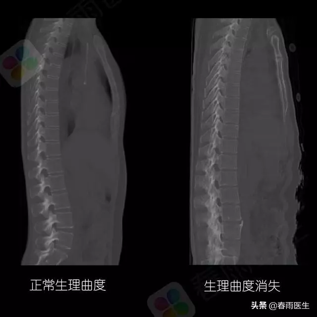 這6種午睡姿勢非常不健康,別告訴我你沒用過