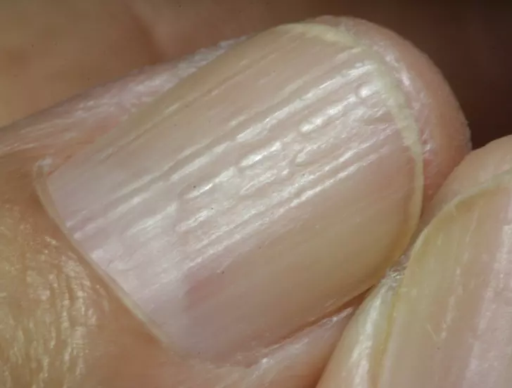 折手指≠關節炎! 12個其實「不用被網路嚇到」的正常生理狀況