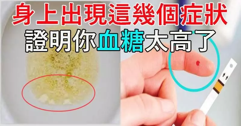 注意!身上出現這幾個癥狀,證明你「血糖」太高了!尤其是你的「尿液」變成這樣,容易發展成「尿毒症了」!