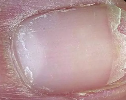 身體長期有這些現象 代表肝已經受損,需要給肝洗洗澡了!