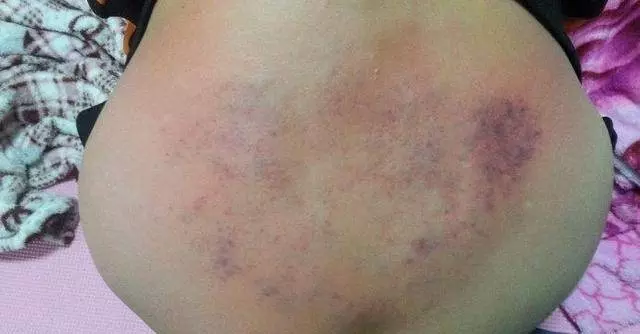 每天拍打腹部溝49次,健脾祛濕氣,減肚子,瘦大腿,全身一天比一天舒服
