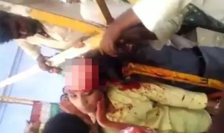 女子頭髮被捲入!男子趁著女子無法動彈,接下來男子舉動讓人憤怒!太無恥了啊!