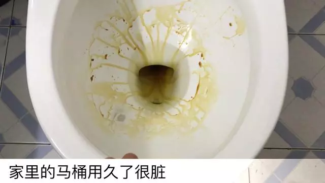 白醋倒在手心上搓一搓,真是太厲害了,解決很多家庭主婦困擾的難題