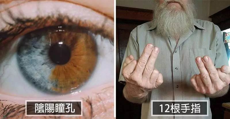 20個「擁抱特殊基因」的現代超級英雄 看耳朵就知道寶寶是「夢幻小精靈」下凡!