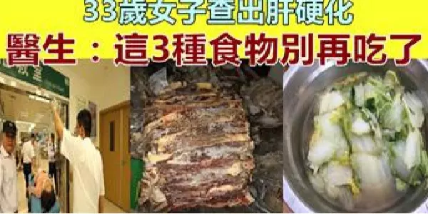 33歲女子查出肝硬化,半夜急救!醫生:3種食物別吃了,傷肝又傷腎!
