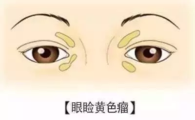 「心臟」好不好,看臉就知道,有9種症狀可能你的心臟出問題了,第3種要特別注意
