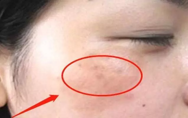 子宮健康的女性,臉上不會有4種表現,常喝1種水,子宮更光滑