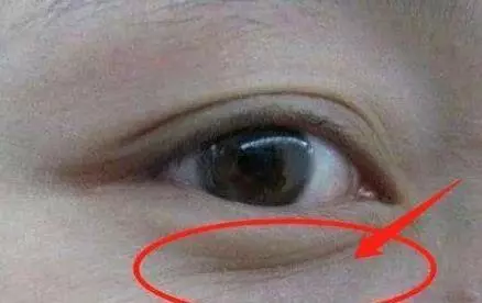 子宮健康的女性,臉上不會有4種表現,常喝1種水,子宮更光滑