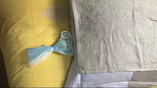 風油精滴生薑上,作用好厲害,解決男女人困擾的難題,一年省下好幾百
