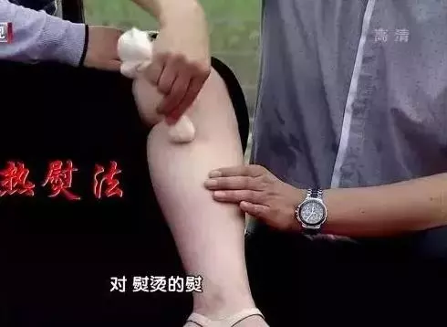 下肢這種疼痛,竟是糖尿病的預警信號!再不重視就晚了
