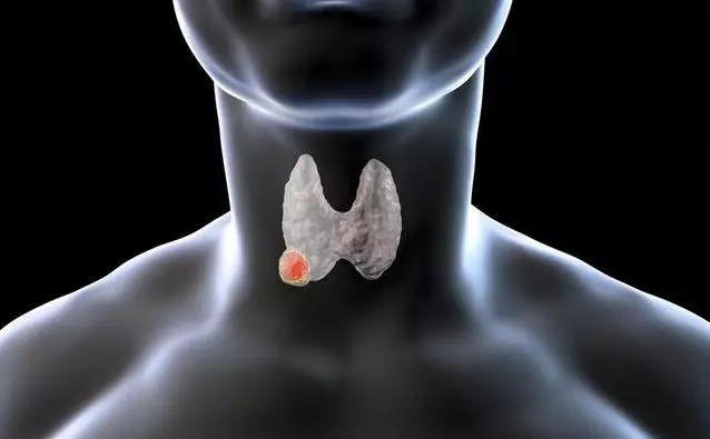 甲狀腺結節不注意,恐變癌!常吃3種''消結王'',或許結節會慢慢變小