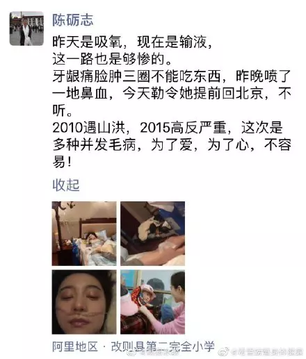 好嚇人!? 到西藏做慈善,范冰冰高原反應『臉腫3圈+鼻血噴滿地』!(內附多圖)