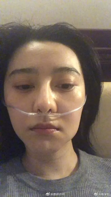 好嚇人!? 到西藏做慈善,范冰冰高原反應『臉腫3圈+鼻血噴滿地』!(內附多圖)