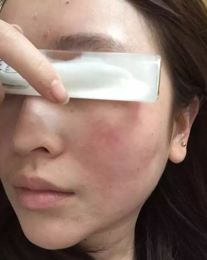 鼻塞就用薄荷Stick?醫師:用久了會『影響嗅覺+鼻竇炎+上癮』? 網友:每天插鼻子裡