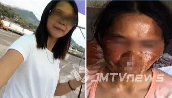 要《小心注意》氣壓鍋煮粥「」爆炸「」 女子慘被「」毀容「」