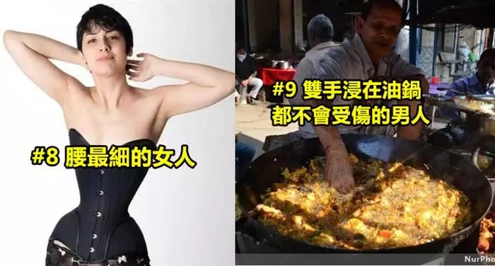 10個真實存在的超奇葩人體構造