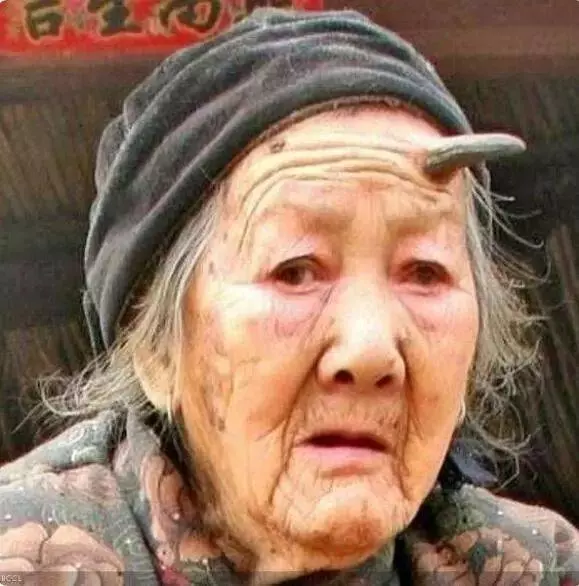 10個真實存在的超奇葩人體構造