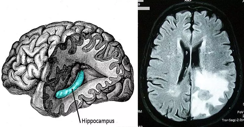 記憶力不好的人一點都不笨!科學家證實:他們大腦的運作,讓他們成了真正的天才...