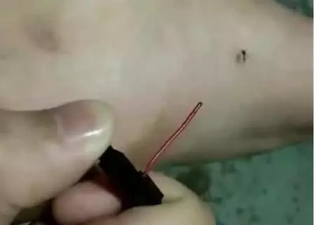 蚊子最高能飛到幾層樓?生物學家給出答案,你買對樓層了嗎?