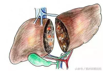 肝不好的人,多吃「3綠」,少吃「2物」,肝會一天比一天好!